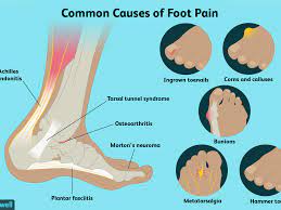 Foot Pain Causes Treatment And When To See A Doctor
