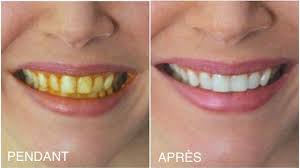 Il lutte contre les ballonnements intestinaux. Comment Blanchir Les Dents Jaunes Avec Du Curcuma 100 Naturel Et Efficace