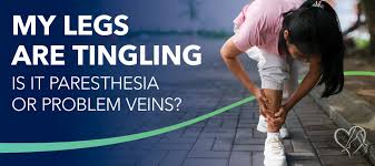 Image result for Paresthesia