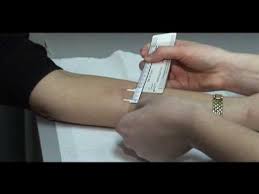 Our clinician will then refer you to your doctor for further testing. Tb Skin Test Mantoux Method Youtube