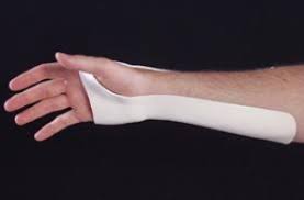Image result for Ulnar Gutter Splint
