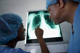 Attach the other end of the support braces to the grill body. Pain Under Right Rib Cage 26 Common Causes Diagnosis And Treatment