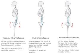 Pin On Body Alignment