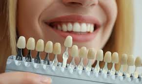 7 Types of Cosmetic Dentistry Procedures