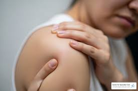 Image result for Shoulder Subluxation