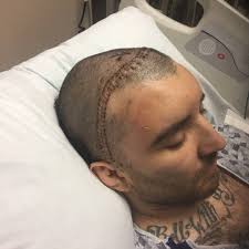 Our Under Armour teammate Kyle Dietz was recently diagnosed with a brain  tumor and had emergency brain surgery. He's an amazing human being, athlete  and inspiration. No doubt he will battle through