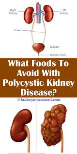Kidney Stones Coke Kidney Disease Recipes Kidney Disease Polycystic Kidney Disease