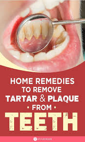 How To Remove Tartar And Plaque From Teeth 11 Home Remedies In 2020 Teeth Health Teeth Remedies Home Remedies