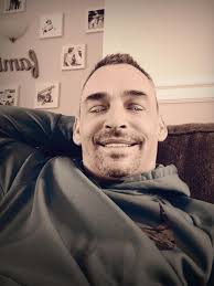 Knee replacement recovery at 5 days post surgery