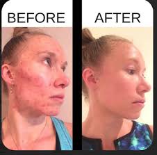 REAL MEN Dont wear make-up. Make-up is a woman thing. AKBAR THE GREAT.  porus was just like a little governor. This is the fact.