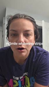 HiSmile Whitening Strips Review and Results