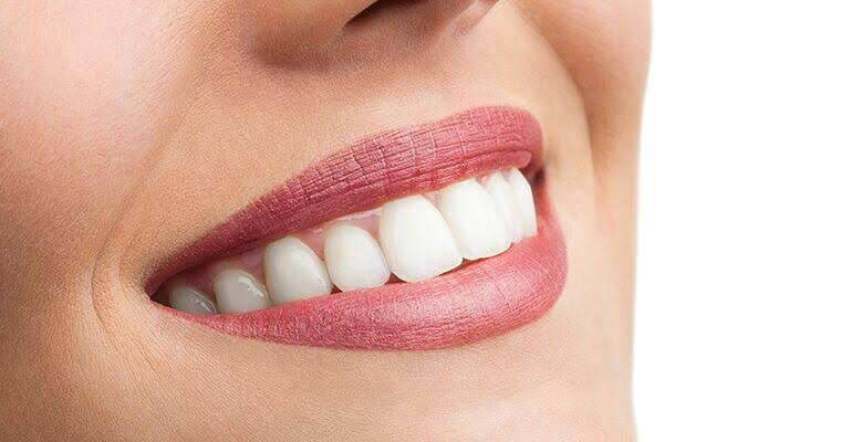 How Long Does Teeth Whitening Last, and What Are The Benefits? | Dental  Health Care of Woburn