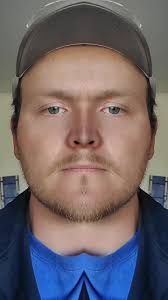 #fyp teeth have never met