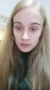 South Londoner misdiagnosed 15 times over disease that felt like having the  'worst hangover' over and over again