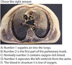 We are a group of people forever changed by the gift of salvation found in jesus christ. The Benefits Of An Augmented Reality Magic Mirror System For Integrated Radiology Teaching In Gross Anatomy Bork 2019 Anatomical Sciences Education Wiley Online Library