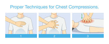 Image result for Chest Compressions