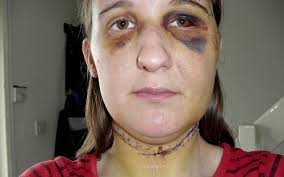 Victim told to write to vicious attacker or face jail herself