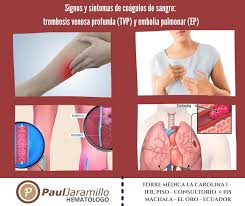 La trombosis, mejor conocida como la sintomatología varía de persona a persona, pero existen algunos síntomas que resultan bastante. El 13 De Octubre Se Dr Paul Jaramillo T Hematologo Facebook