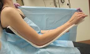 Image result for Long Arm Splint