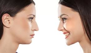 Hokusai audio editor è una app ios compatibile con iphone, ipad e ipod touch. Correzione Della Punta Del Naso Estheticon It