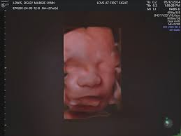 Emily Lewis (@emmylewww) • Instagram photos and videos