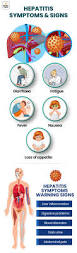 Image result for hepatitis symptoms