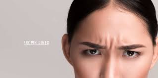 Frown Lines - Ensoul Medical Clinic