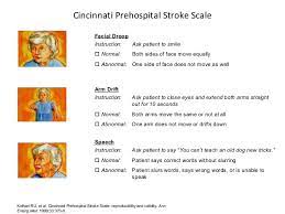 Maybe you would like to learn more about one of these? Stroke Assessment Physiopedia