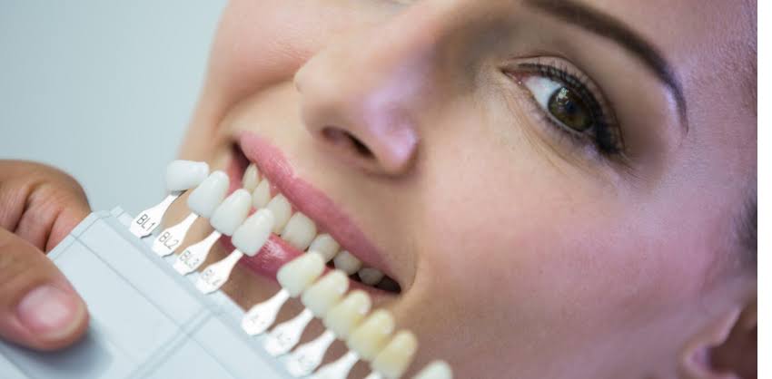 Teeth whitening product image