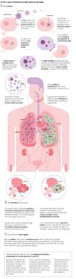 O que acaba acontecendo é que o coração não funciona de uma forma normal como deve funcionar. Tempestade Inflamatoria Ajuda A Explicar Mortes Pela Covid 19 Associacao De Gastroenterologia Do Rio De Janeiro
