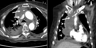 نتیجه جستجوی لغت [widened] در گوگل