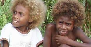 Prices shown in your local currency. Aborigines And Melanesians Naturally Blonde Hair And Dark Skin