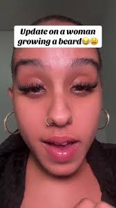 Brenda Rose The Bearded Lady