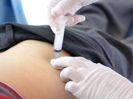 نتیجه جستجوی لغت [injection] در گوگل