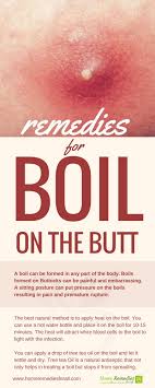 Boils may be also caused because of blocked sweat glands. Pin On Home Remedies