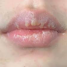 We did not find results for: Bibir Mengelupas Wildriftlol Twitter