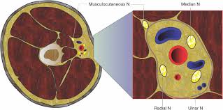 Image result for Axillary Nerve Block