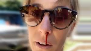 Dani es actriz, cantante y humorista. Golpearon Salvajemente A Dani La Chepi Y Termino Sangrando Diario La Provincia Sj