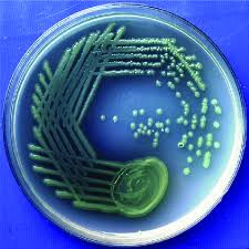 Have the ability to exchange genes by conjugation or horizontal gene transfer that may lead to the spread of virulence among strains and species. Pseudomonas Aeruginosa On Nutrient Agar Download Scientific Diagram