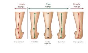 Image result for Shin Splints