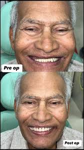 At the end of the day, it’s not just treatments we count — it’s the smiles  we restore. Watching our patients eat, laugh, and live freely, even in  their golden years, is what keeps Khare Dental going., ...