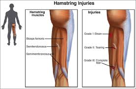 Leg muscles functions to perform all the motions and movements of the lower limb like standing, running, dancing etc. Hamstring Strain Peak Sports And Spine Centre