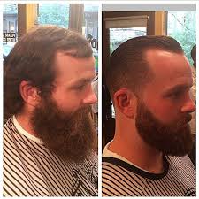 Untitled Receding Hairline Styles Trimming Your Beard Faded Beard Styles