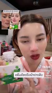 ດາປ໊ອບສະກິນ