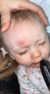 Dad's Vag Assaults 9MO Covers Child In Clothes, Head Band & Socks To Cover  Bruises