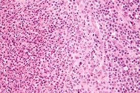 Image result for Blotiella