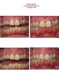 Pin On Before And After Pictures