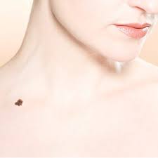 skin cancer (adenocarcinoma) is an overgrowth of cells that make up the sebaceous glands. Skin Cancer Faq Skin Cancer Types Symptoms Laser And Skin Surgery Center Of Indiana