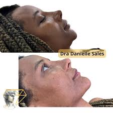 Dra Danielle Sales l Harmonização Facial Definitiva (@dentistabrasilia) •  Instagram photos and videos