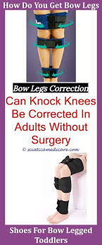 Get your query answered 24*7 only on | practo consult. Bow Legs Correction Bow Legs Correction Bow Leg Correction Surgery Bow Legs Solution How Do You Become Bow Leg Bow Legged Correction Bow Legged Knock Knees